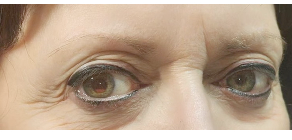 Permanent Eyeliner Top & Bottom